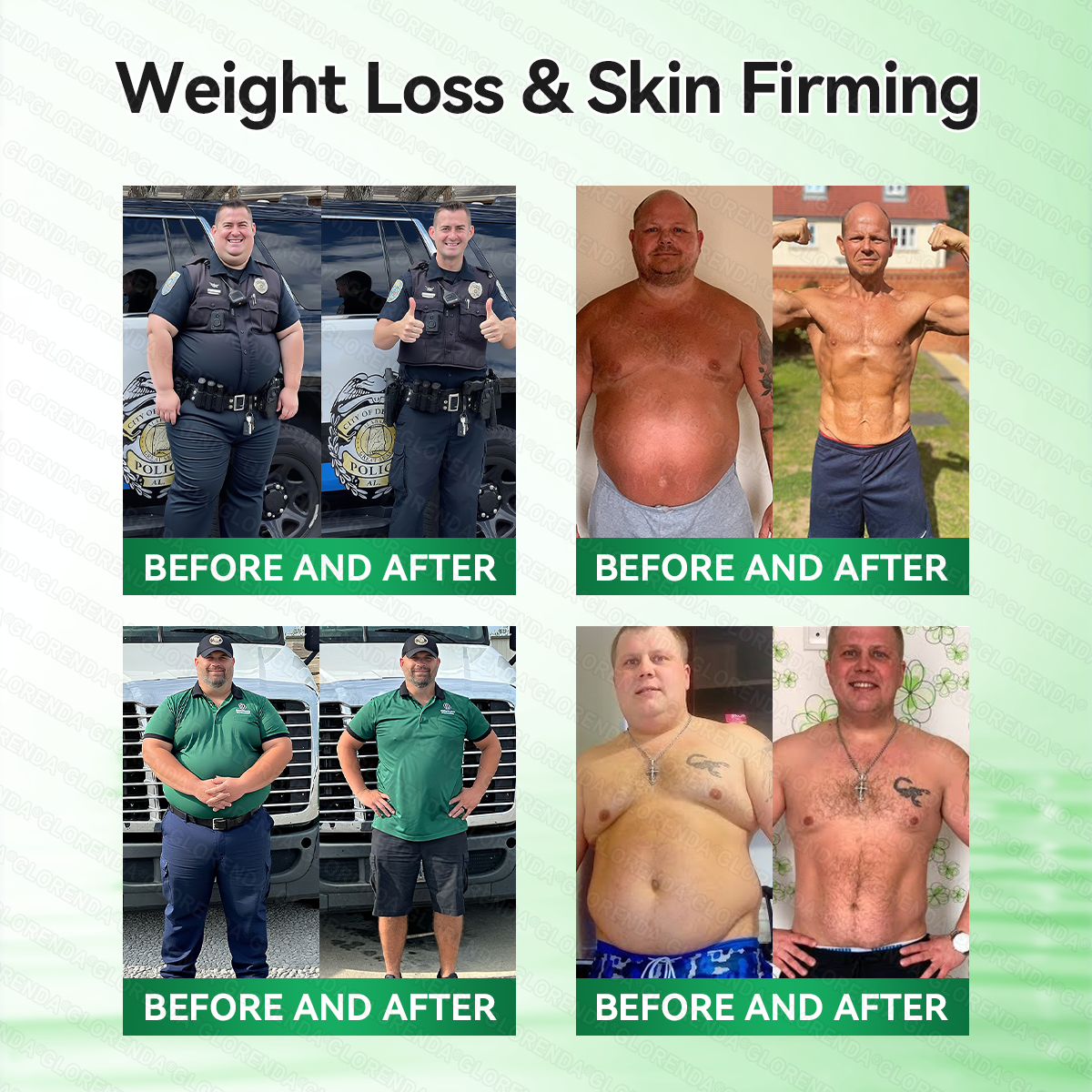 🇨🇦𝑶𝒇𝒇𝒊𝒄𝒊𝒂𝒍 𝑺𝒕𝒐𝒓𝒆  | 🏆🏆𝐆𝑳𝑶𝗥𝗘𝗡𝘿𝘼® 𝙈𝒐𝒓𝒊𝒏𝒈𝗮 · 𝗕𝗲𝗿𝗯𝐞𝐫𝐢𝐧𝙚 × 𝙉𝑨𝑫+ 𝟏𝟎-𝙞𝙣-𝟏 𝘼𝒅𝒗𝒂𝒏𝒄𝒆𝐝 𝐍𝐚𝐧𝙤 𝙈𝙞𝙘𝙧𝙤𝙣𝒆𝒆𝒅𝒍𝐞 𝐏𝐚𝐭𝙘𝙝(𝐉𝐮𝐬𝐭 𝐨𝐧𝐜𝐞 𝐚 𝐝𝐚𝐲, 𝐯𝐢𝐬𝐢𝐛𝐥𝐞 𝐜𝐡𝐚𝐧𝐠𝐞𝐬 𝐢𝐧 𝟕 𝐝𝐚𝐲𝐬） ✅ 𝐅𝐨𝐫 𝐨𝐛𝐞𝐬𝐢𝐭𝐲, 🅛🅞🅞🅢🅔 🅢🅚🅘🅝,𝐝𝐢𝐚𝐛𝐞𝐭𝐞𝐬, 𝐬𝐥𝐞𝐞𝐩 𝐚𝐩𝐧𝐞𝐚, 𝐣𝐨𝐢𝐧𝐭 𝐢𝐬𝐬𝐮𝐞𝐬, 𝐚𝐧𝐝 𝐦𝐨𝐫𝐞